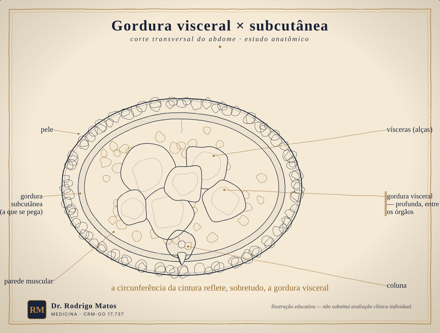 Corte transversal do abdome comparando gordura subcutânea e gordura visceral