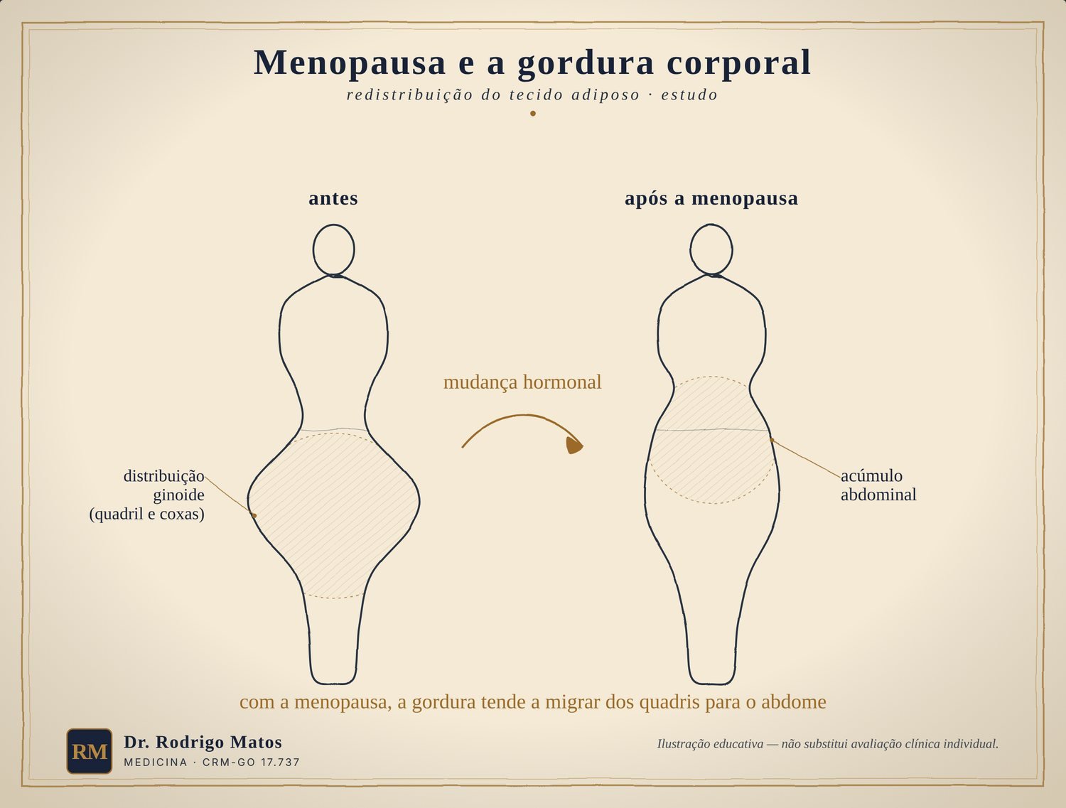 Duas silhuetas mostrando a redistribuição da gordura corporal após a menopausa